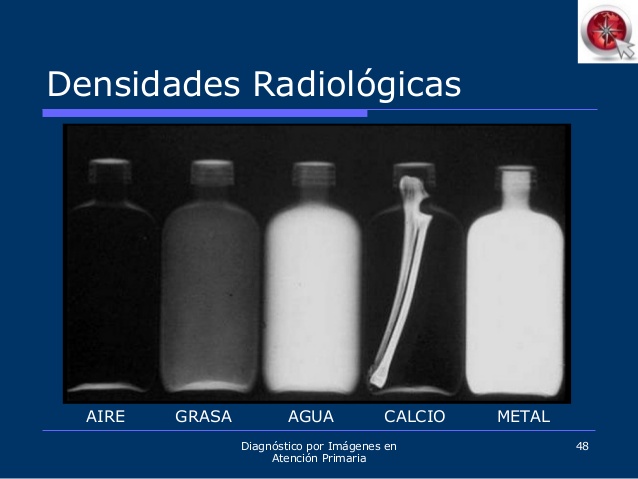 radiologa-del-abdomen-48-638